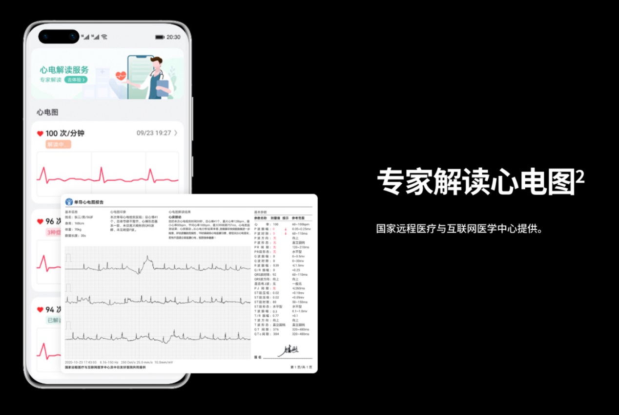 华为开启体温、血压、冠心病健康研究项目：华为手表或首发支持,第3张